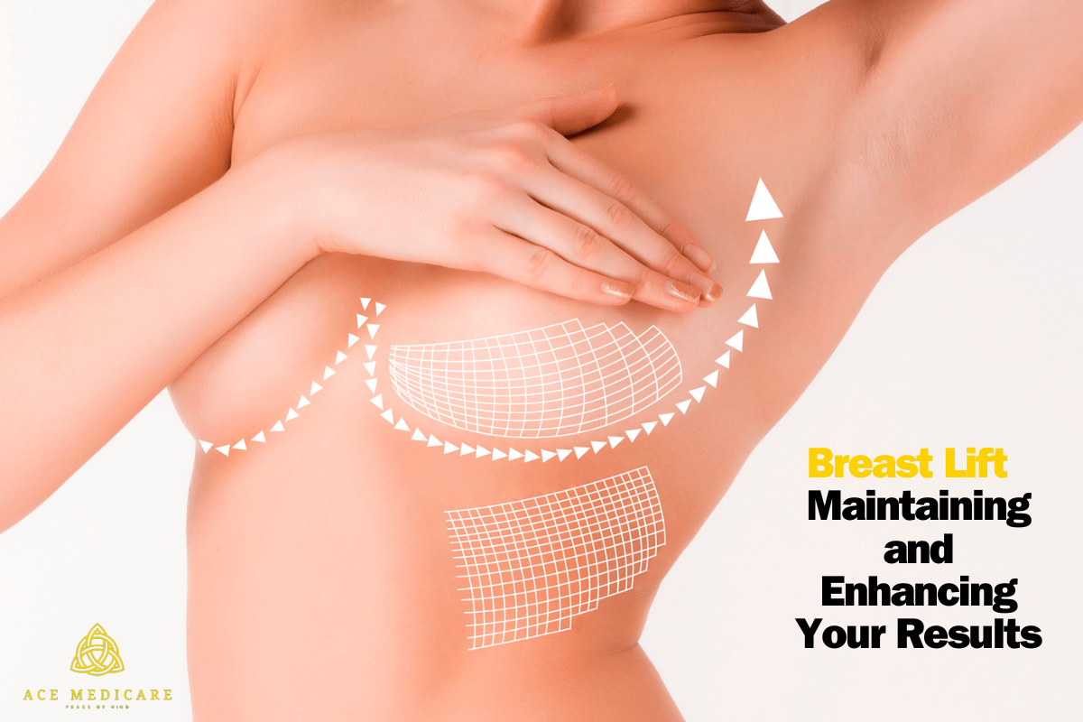 The Ultimate Guide to Post-Breast Lift Care: Maintaining and Enhancing Your Results